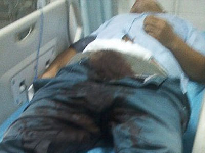 Έκοψε το πέος του και πήγε στο νοσοκομείο με το ποδήλατο